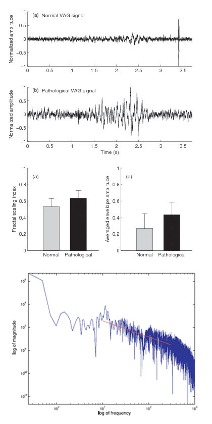 VAG signal analysis